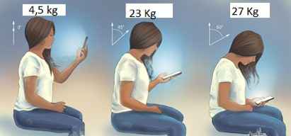 problemas musculares en el cuello uso del móvil