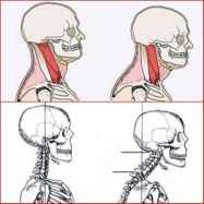 La musculatura cervical anterior y sus problemas derivados del uso excesivo del móvil